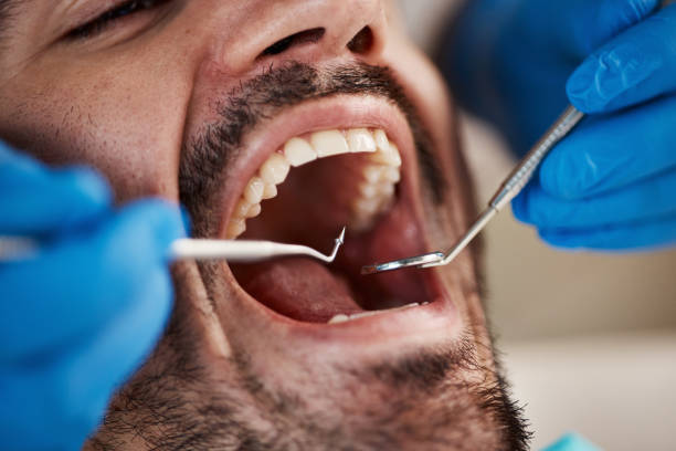 Best Root Canal Treatment  in Belvedere, CA