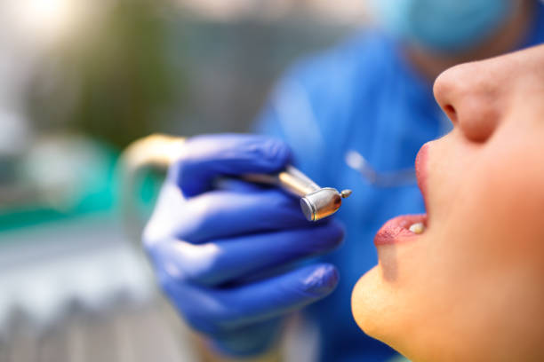 Best Wisdom Tooth Removal  in Belvedere, CA